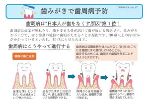 2025.01　【プチ】歯周病のサムネイル